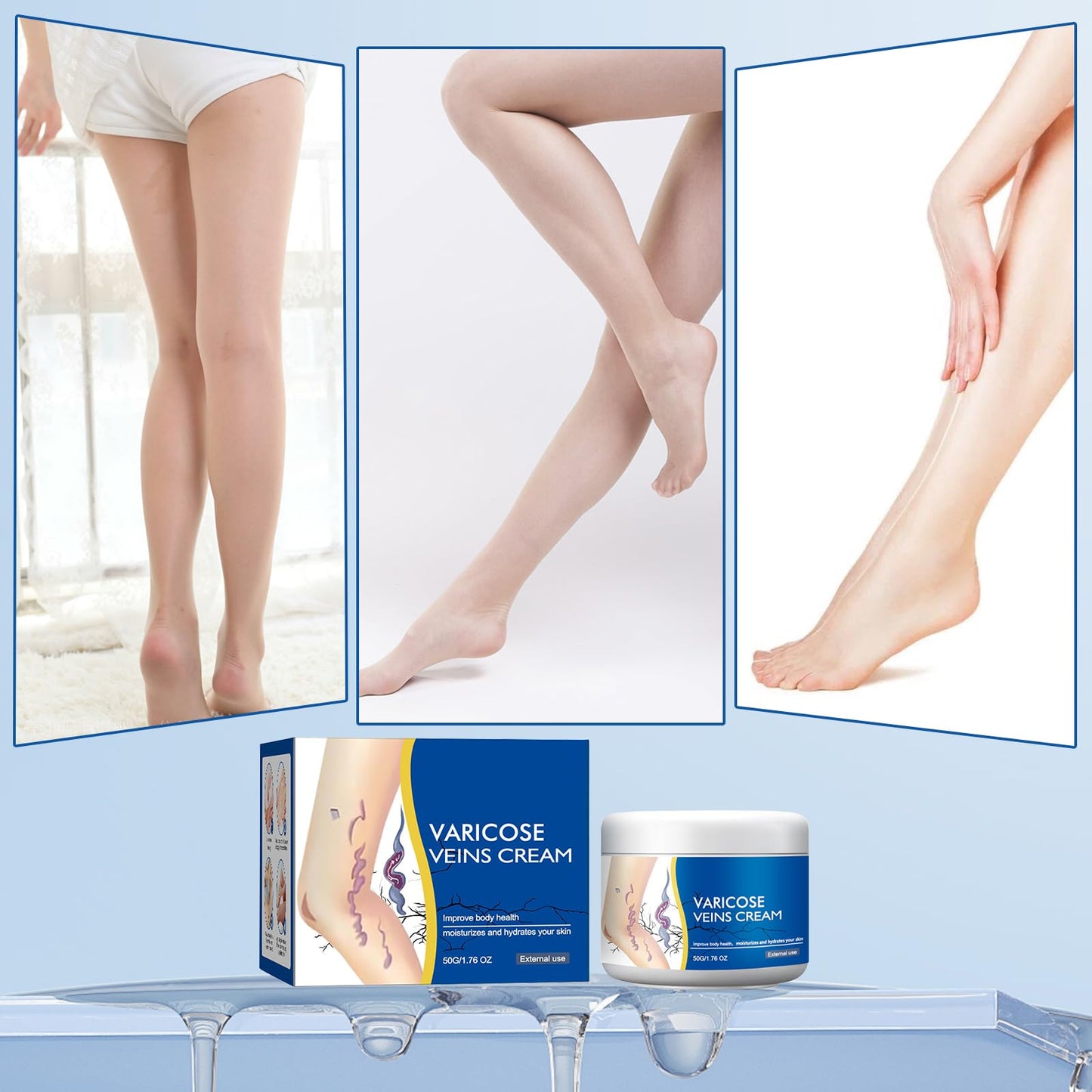 2Pcs Varicose Veins Treatment Cream for Legs Natural Ingredients, Suitable for Most Skin Types