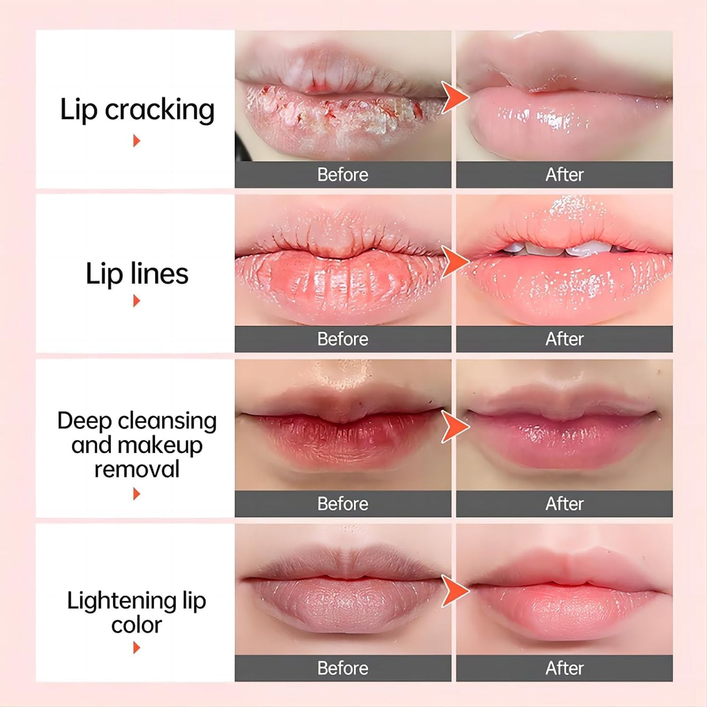 2PCS Fast Remove Dark Lip Balm Serum Lighten Melanin Lip Mask Exfoliating Fade Lip Lines Dead Skin Nourishing Repair Lip Care Makeup