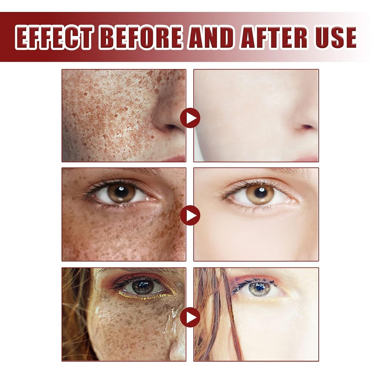 RESOVTE Cremas Para Manchas En La Cara, Cream Skin Tone Imperfections Care, Cremas Para Quitar Manchas De La Cara, Crema Para Manchas En La Cara, Crema Para Las Manchas De La Cara (4PCS)