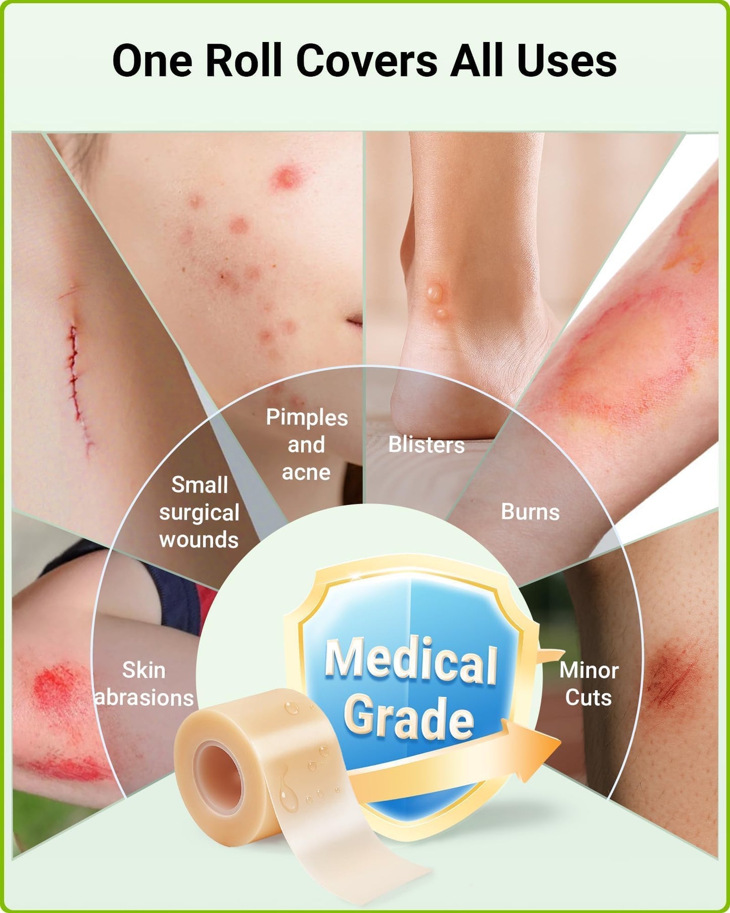 Hydrocolloid Roll Bandages for Wound Care, Kovoq Medical Grade Hydrocolloid Pimple Patches Tape Sterile and Waterproof, with DIY Size & Shape Tools Scissor and Tweezer (2in * 12ft)