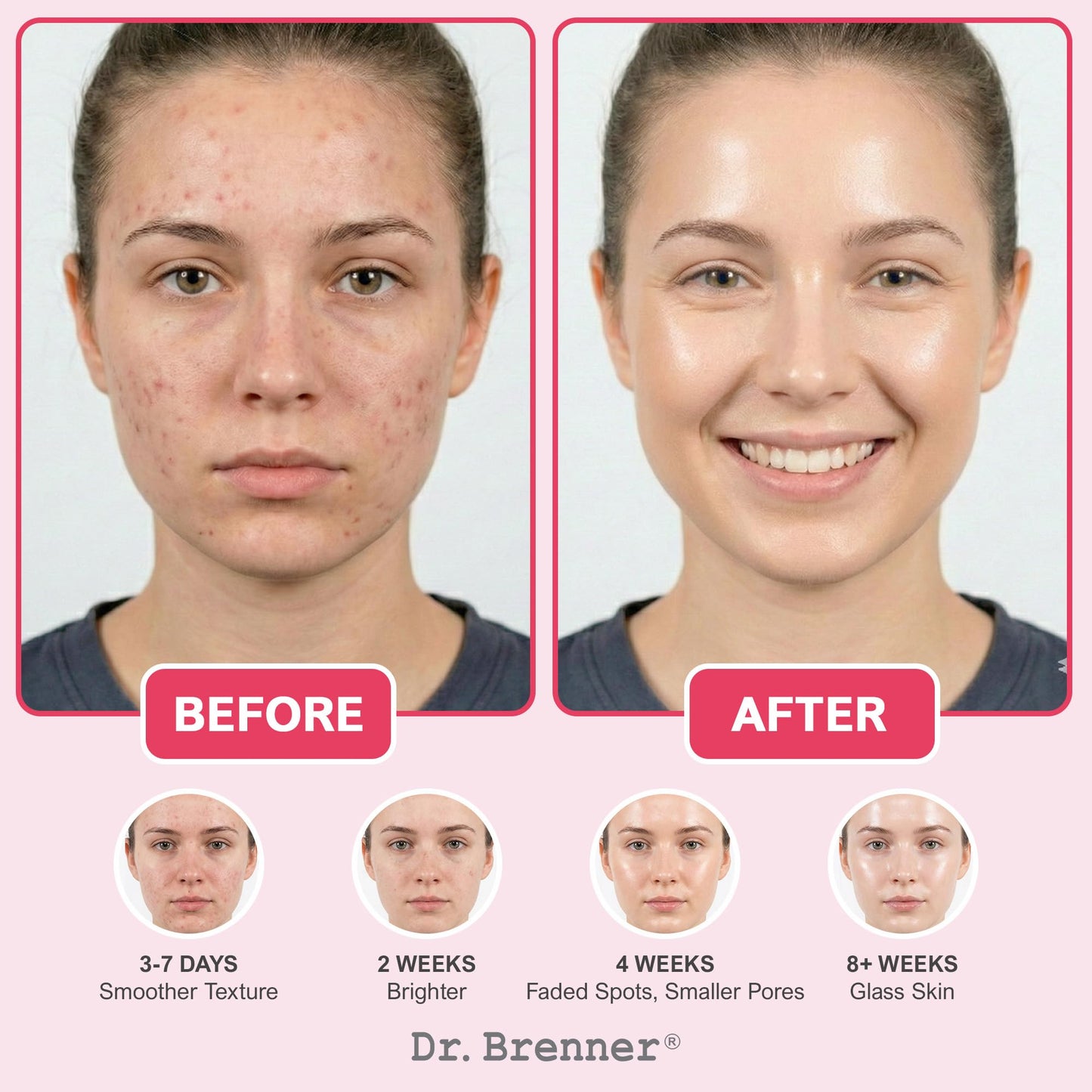 Niacinamide serum10% + TXA 4%, Tranexamic Acid Dark Spot Corrector with Zinc 1% & Arbutin 2% - Brightening Serum for Hyperpigmentation, Acne Scars, Uneven Skin Tone, Glass Skin