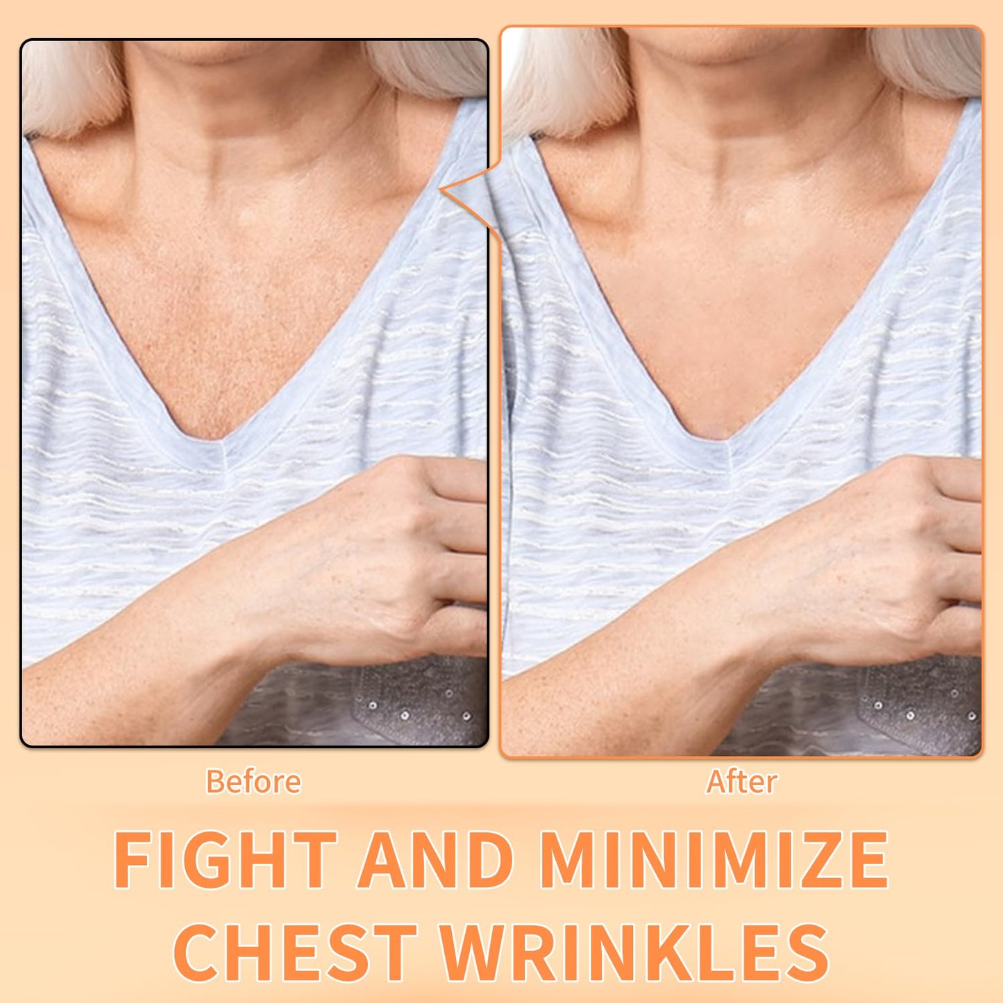 Auxbales Chest Wrinkle Pads 4 Pack Reusable | Medical Grade Anti-Wrinkle Patches | Hypoallergenic & Long-Lasting | Smooth & Youthful Skin | Silicone Chest Patches for Wrinkles