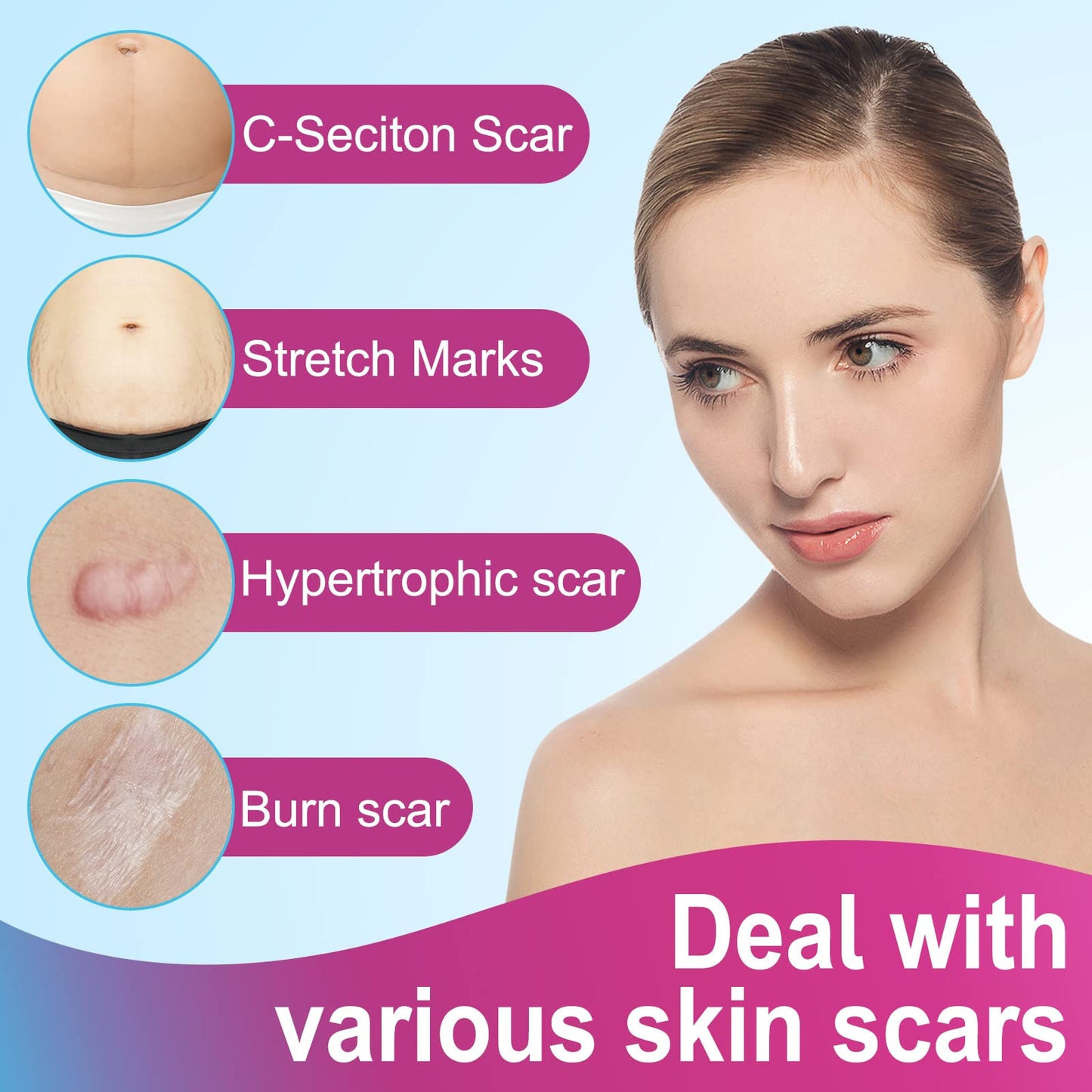 Silicone Scar Sheets (1.6” x 75”-1.9M), Medical Grade Soft Silicone Scar Tape, Scar Strips, Scar Roll - Keloid, C-Section, Surgical, Acne- Scars Removal Treatment, Painless Easy Removal, Reusable
