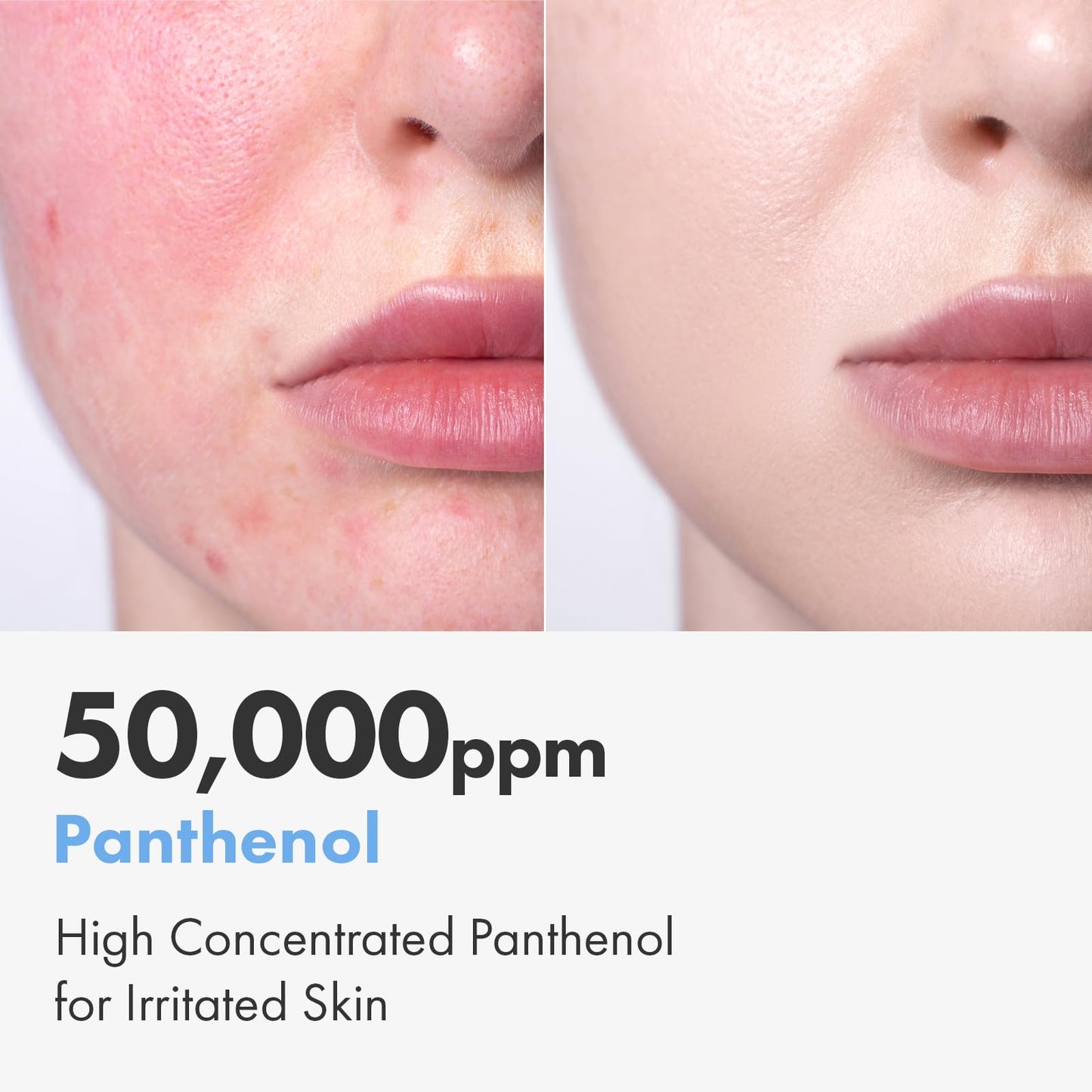 NATUREKIND Cica Panthenol Cream, 50,000ppm Panthenol, Centella Asiatica & Hyaluronic Acid, Barrier Repair Moisturizer for Dry, Sensitive Skin, Korean Skincare, 150g, 5.29 oz.