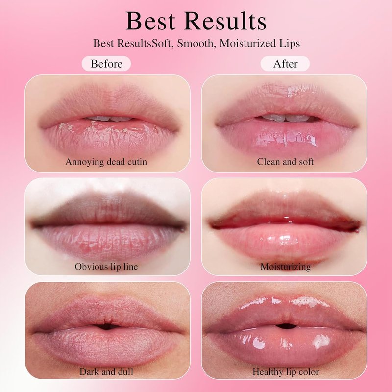 PHA 5% Lip Exfoliator - Gentle Salicylic Acid Formula for Overnight Hydration | 0.5 fl oz (15 mL)
