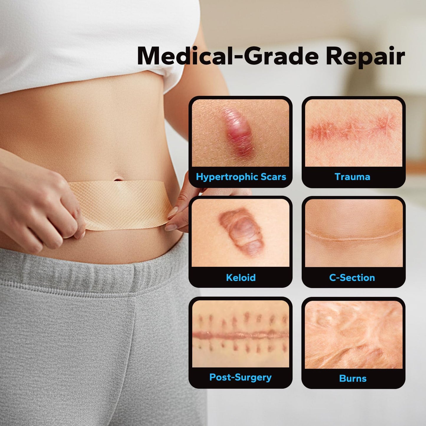 Belolo Silicone Scar Sheets (1.6" x 60" Roll - 1.5M), Silicone Scar Tape, Silicone Scar Sheets for Surgical Scars, Keloids & C-Section Scars, Reusable & Washable Scar Patches for Face & Body