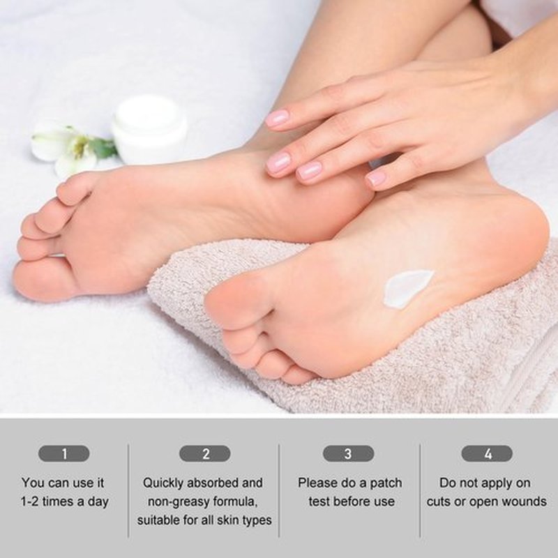 Urea Cream 40 Percent for Feet 5.29oz - Maximum Foot & Hand Cream, for Dry, Cracked Heels, Feet, Knees, Elbows, and Hands,Callus Remover, Strength Urea Lotion for Softening and Moisturizing