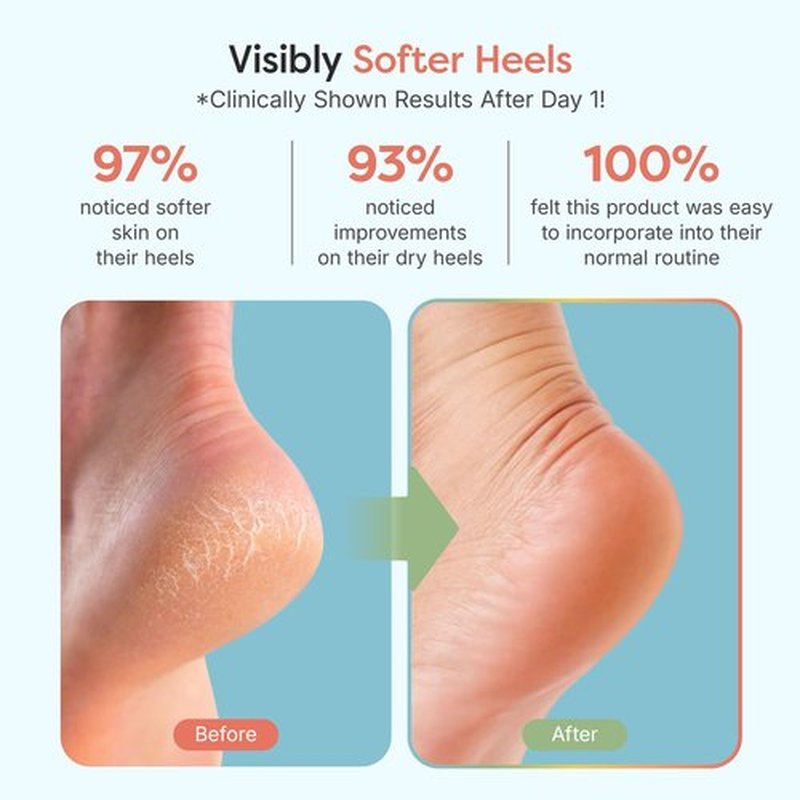 ZenToes Moisturizing Sleep Socks with Vitamin E, Olive Oil and Jojoba Seed Oil to Soften and Hydrate Dry Cracked Heels (Fuzzy Blue, 1 Pair Regular)
