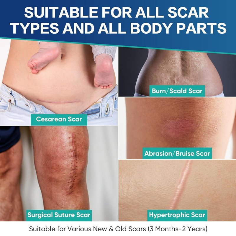 Medical Grade Silicone Scar Sheets - Advanced Treatment for Surgical, Burn & Keloid Scars | Flexible 4"x4" Strips