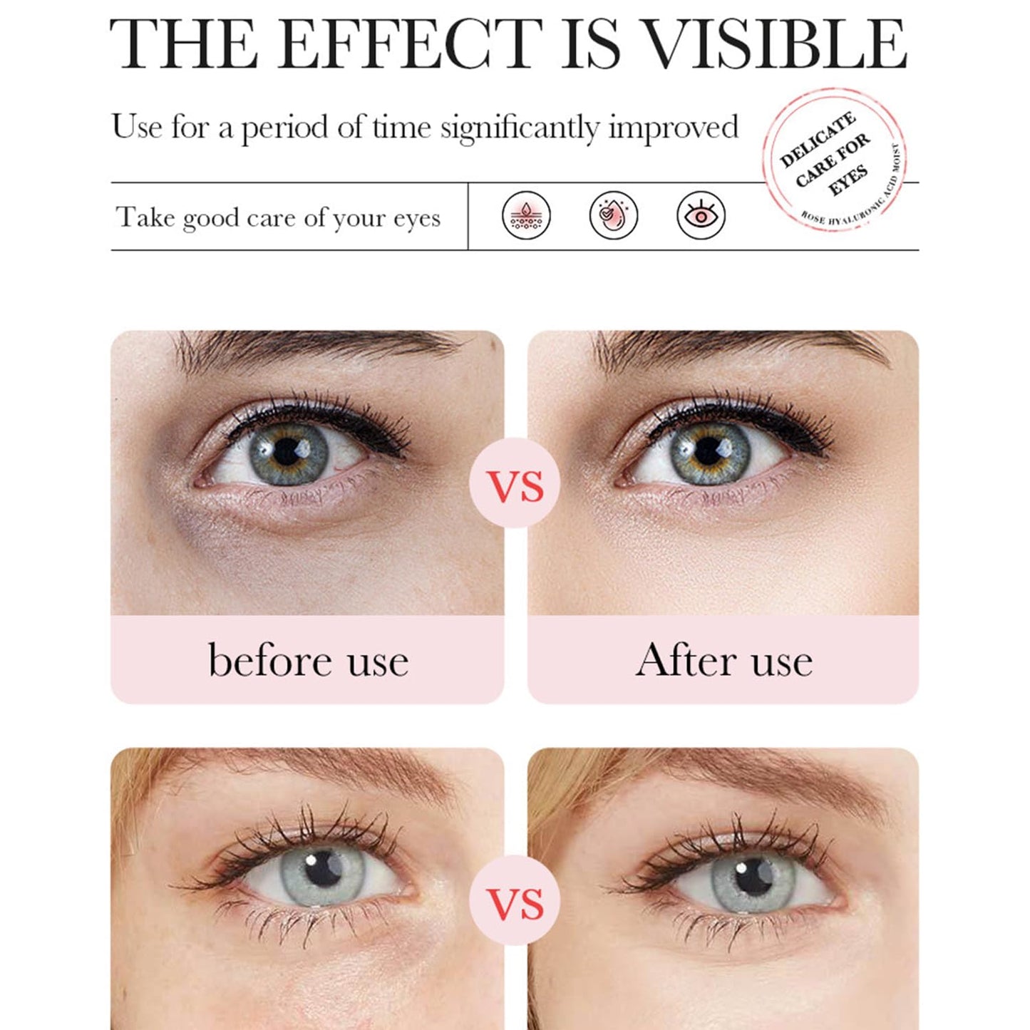 Rose Eye Masks, 60 PCS Eye Patches for Puffy Eyes and Dark Circles, Hydrating Eye Mask Skincare, Eye Patch, Parches Para Ojeras, Under Eye Bags, Reduce Wrinkles and Fine Lines, Improve Eye Skin