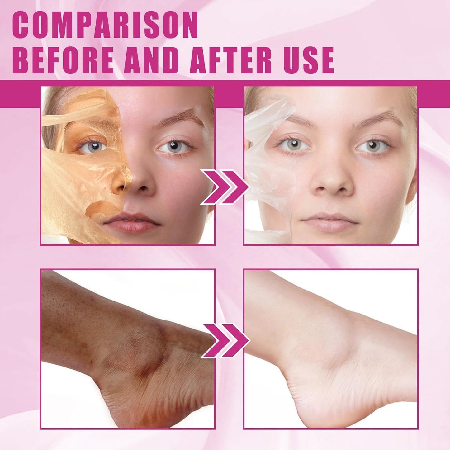 Generic Extra Strong Peeling Oil, Peeling Oil for Dark Skin, Yellow Peeling Oil, Exfoliating Peeling Solution for Hand Feet, Chemical Peel for Face, 110ML / 3.88 OZ (1 PCS)