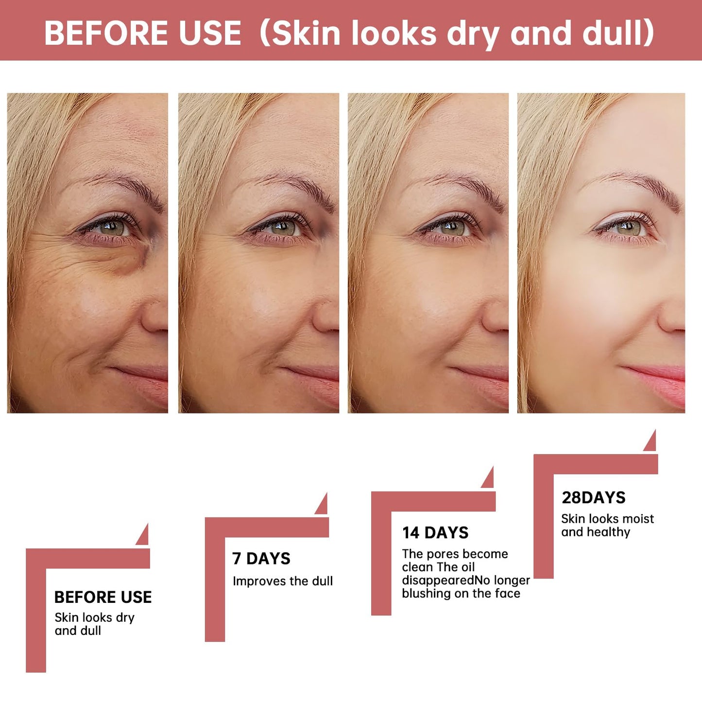 AHA 30% + BHA 2% Peeling Solution 30ml/1oz, Exfoliating Facial Serum, Chemical Peel For Face Serum Glycolic Acid