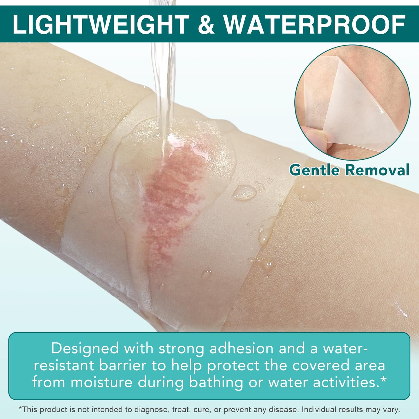 Hydrocolloid Bandages, Medical Grade Hydrocolloid Roll for Wound Care, Waterproof & Flexible Wound Dressing Roll, Extra Large Hydrocolloid Patch Bandages with Self-Adhesive-2in*11.8ft