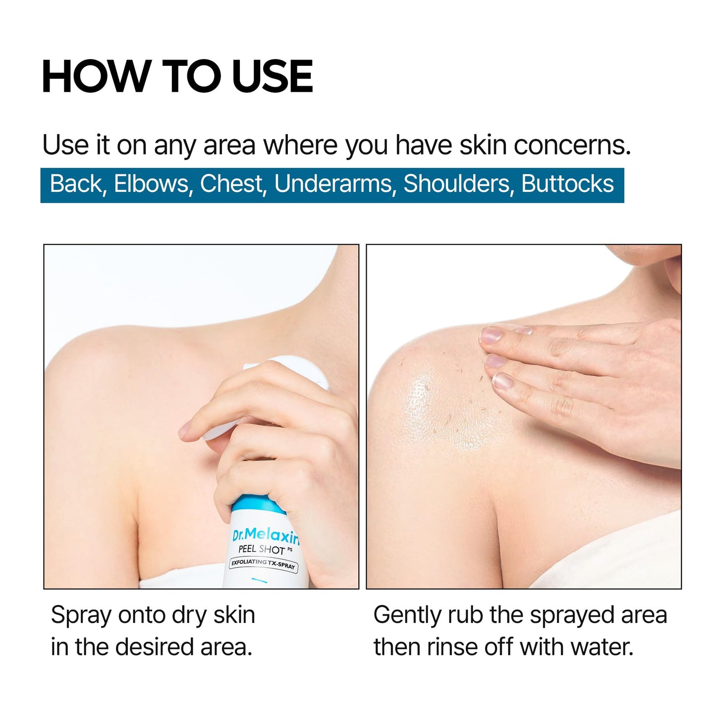 Dr.Melaxin Peel Shot Exfoliating TX-Spray 6.76 fl.oz - 99% Tranexamic Acid and Niacinamide Body Exfoliator Spray for Uneven Skin Tone, AHA PHA Body Peel for Rough Skin, K-Beauty Body Brightening