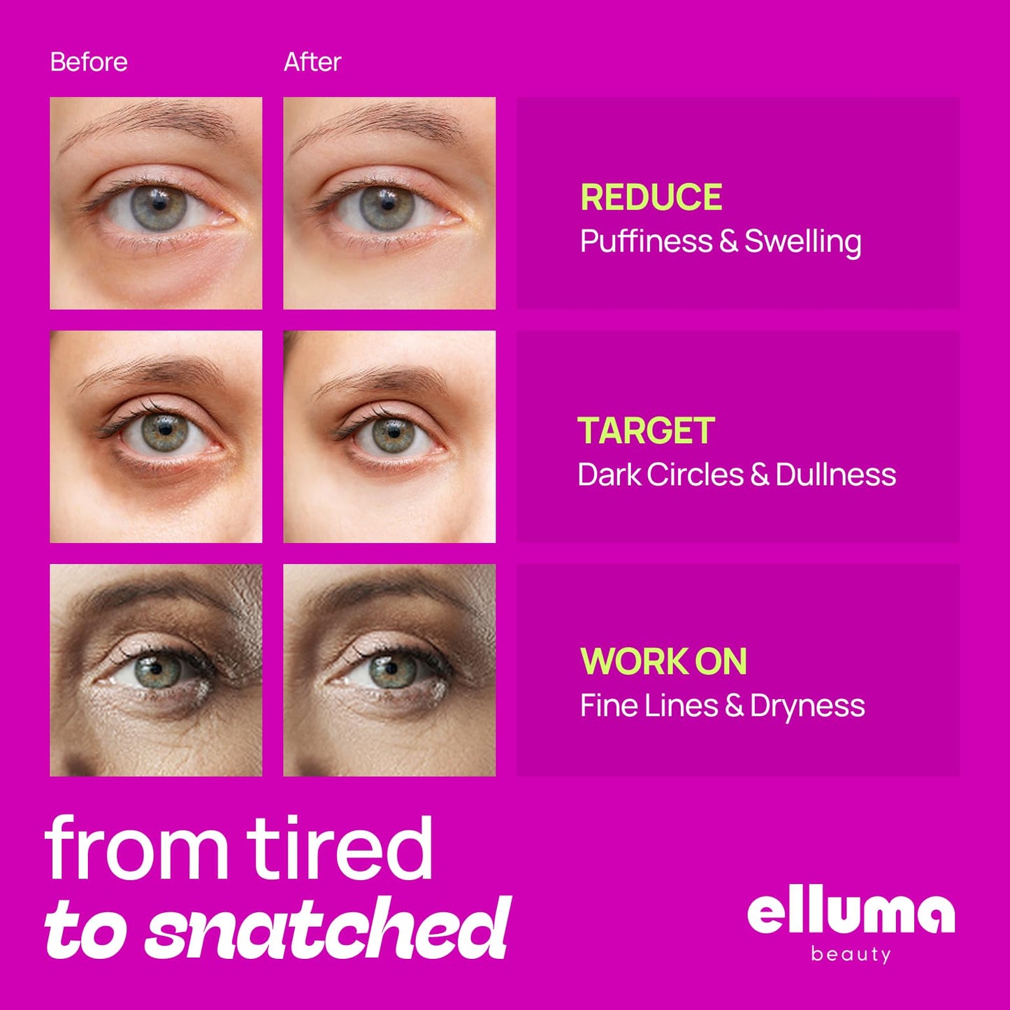 Elluma Beauty Under Eye Patches 12 Pairs of Themed Hydrogel Eye Gel Pads - For Puffy Eyes and Dark Circles, Under Eye Bags, Wrinkles - Mix Set | Energizing, Hydrating, Restoring, Hungover