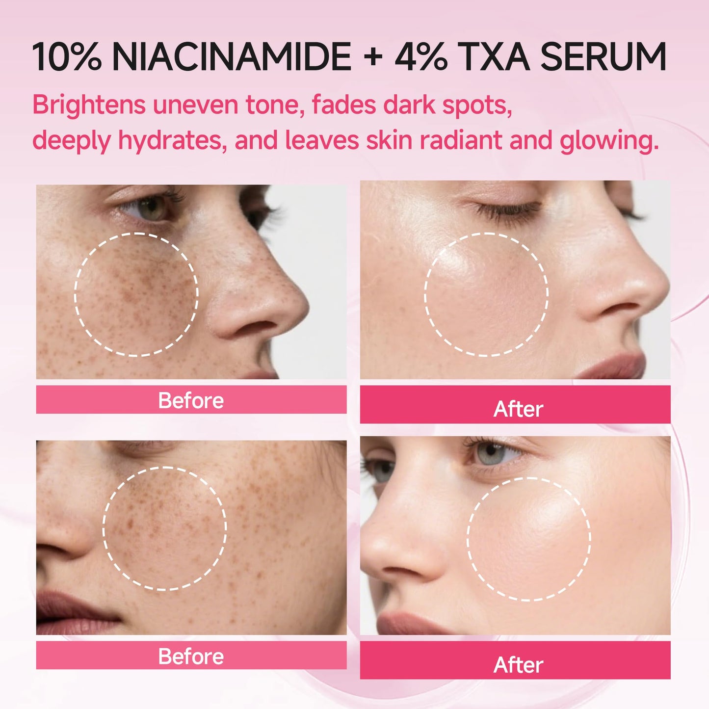Niacinamide 10% + TXA 4% Serum: Hyaluronic Acid Tranexamic Acid Facial Serum for Face Dark Spot Refining Anti-Aging Redness Radiant Korean Skin Care for Face 30ml /1.01 fl.oz