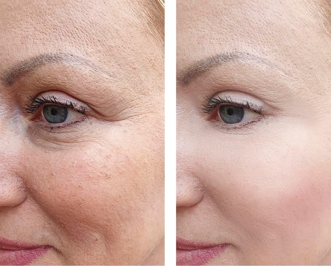 Vitality Precision Skin Advanced AGE Interrupter Cream - Anti-Aging Moisturizer 1.6 oz