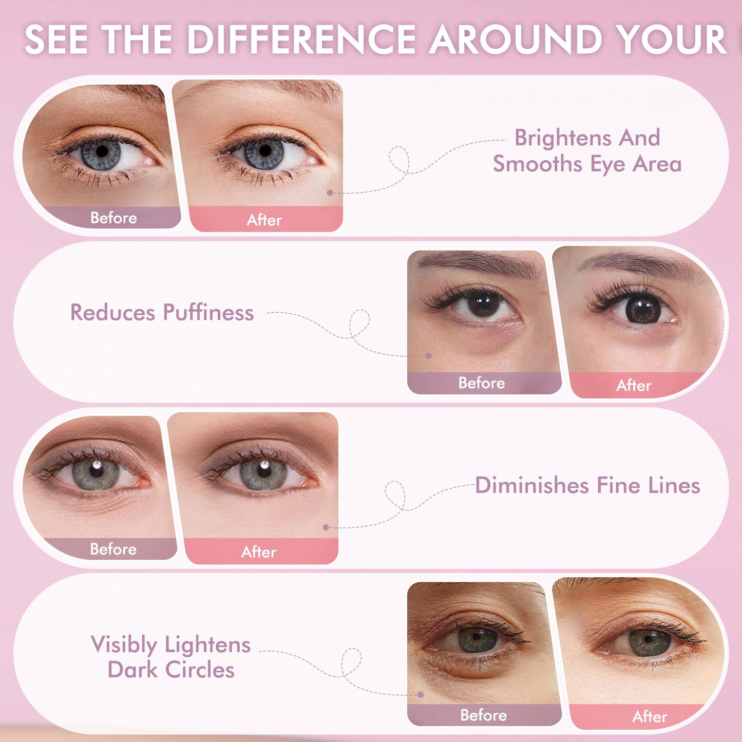 AzLucaky Under Eyes Patches, 40 Pairs Rose Hydrogel Eye Mask for Puffy Eyes and Dark Circles with Rose Essence, Hyaluronic Acid & Niacinamide, Deep Hydrating Eye Treatment for Men & Women