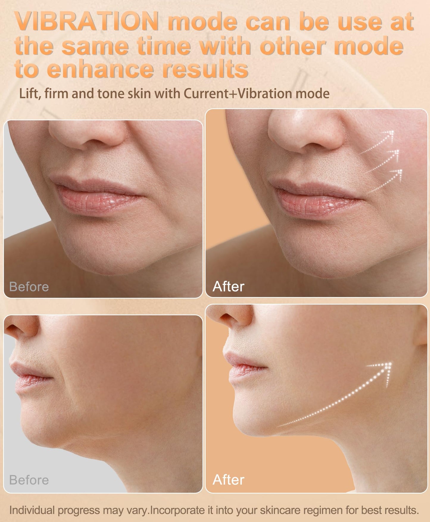Radio-Frequency Skin Tightening Device | 6 in 1 Home-RF Face Beauty Device | Professional Facial Skin Tightening | Lifting | Wrinkle Reducing | Anti Aging | Depuff | Increase Absorption(with Gel)
