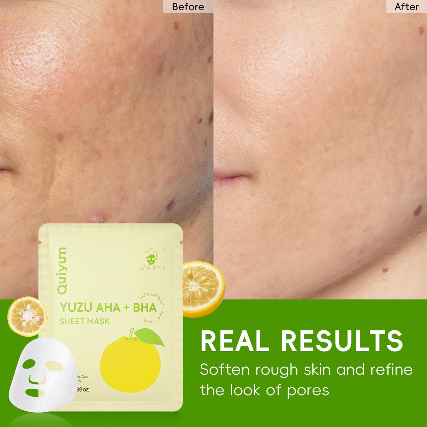 QUIYUM 14 Pack YUZU Sheet Mask - Oil control Facial Masks for Women & Teens