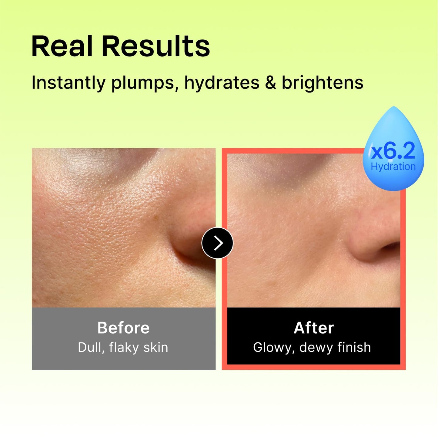 Celladix Hyaluronic Intense Serum – 95% Pure Hyaluronic Acid with Jeju Deep Sea Water & Peptides – 100 Hours of Hydration, Gentle Soothing Care for Radiant Skin – Korean Skincare, 1.69 Fl Oz
