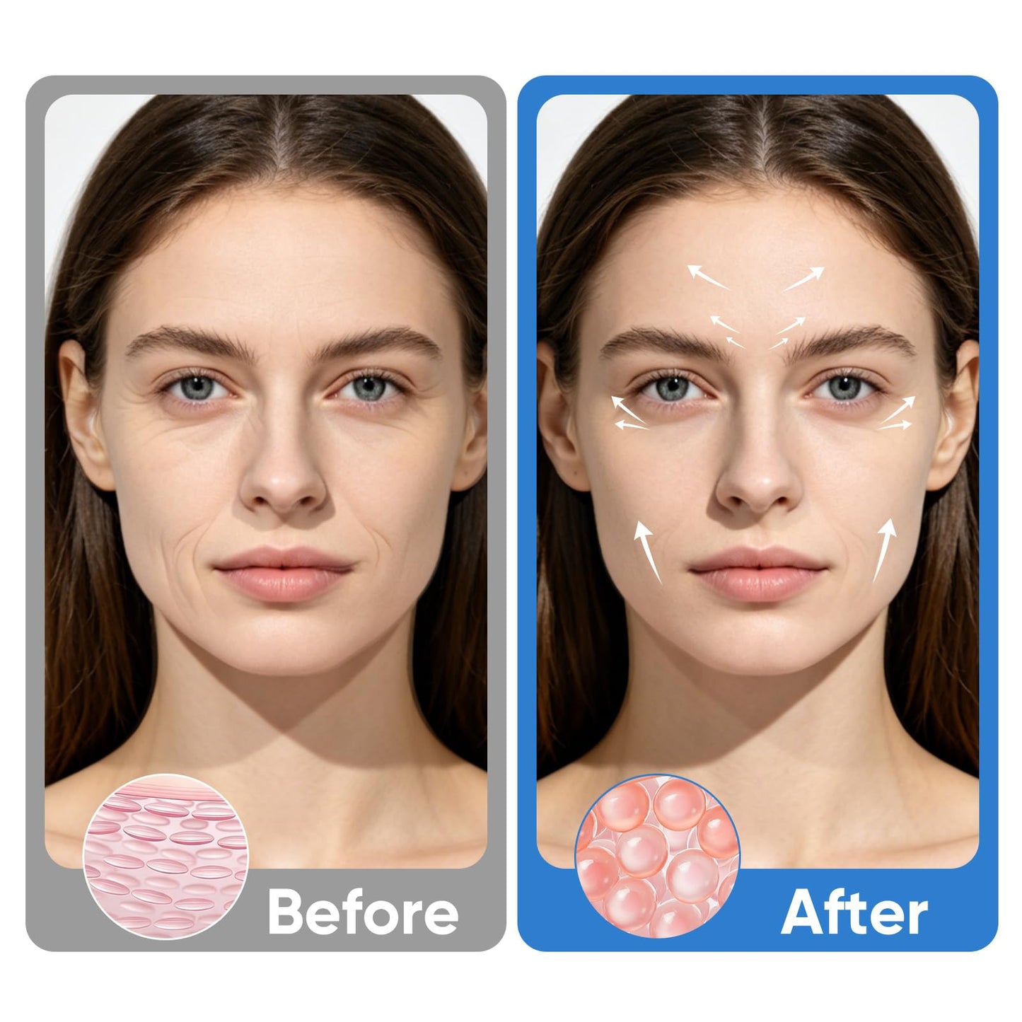 Dissolving Micro-Patches with Hyaluronic Acid & Collagen - DImprove Facial Sagging & Firm The Contours - Wrinkle Patches for Forehead & Nasolabial Folds
