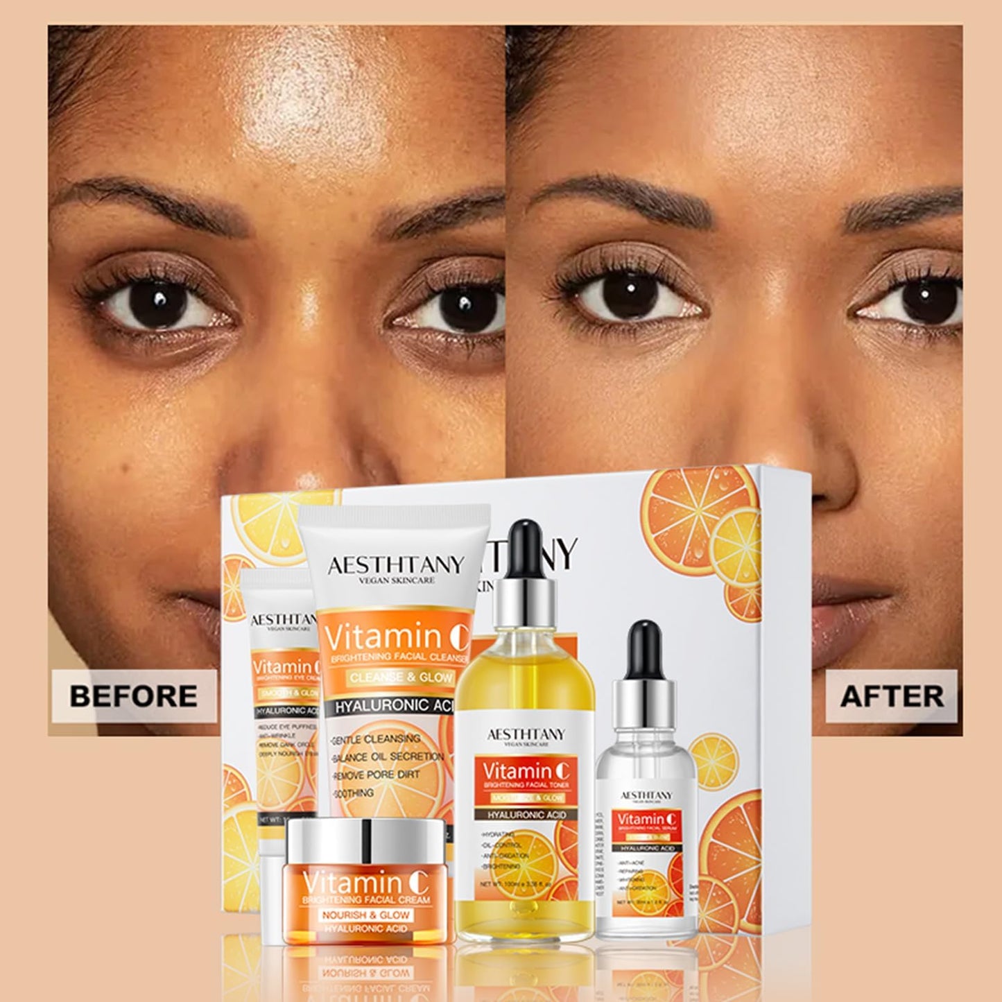 R RadiantRise Vitamin C Skin Care Set For Women , 5-In-1 Moisturizing Hyaluronic Acid Skin Care Routine with Facial Cleanser, Serum, Face Cream, Eye Cream, Toner