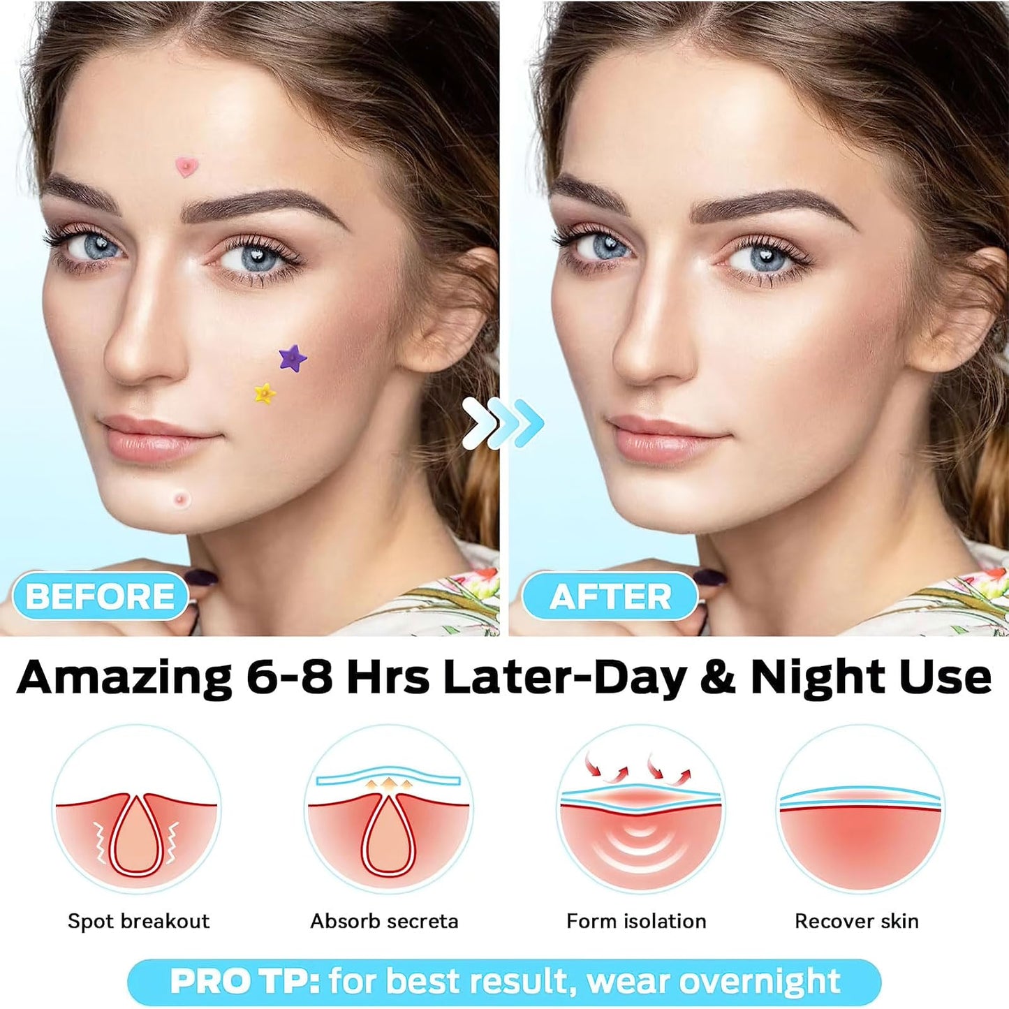 Pimple Patches for Face Cute Star Haydrocolloid Acne Patches Tea Tree oil Salicylic Acid Cica oil Colorful Invisinble Acne Removal Skin Care Stickers