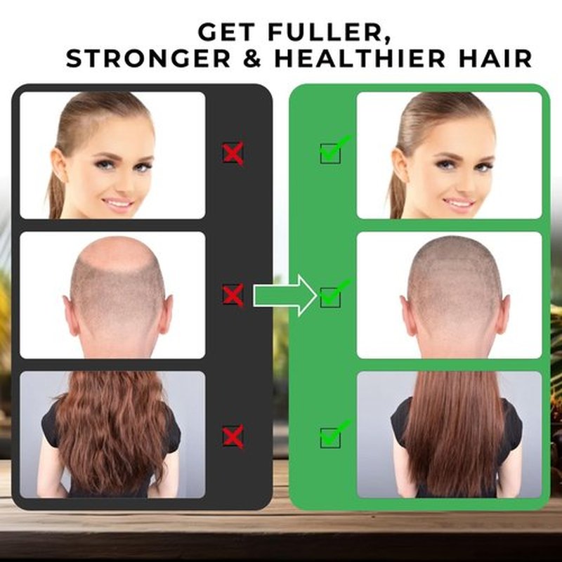 Mysense Raw Batana Oil for Hair Growth, 100% Natural Pure and Unrefined Dr. Sebi Hair Oil, Scalp and Hair Care for Women & Men, Prevent Hair Loss, Promote Hair Thickness, 60 g