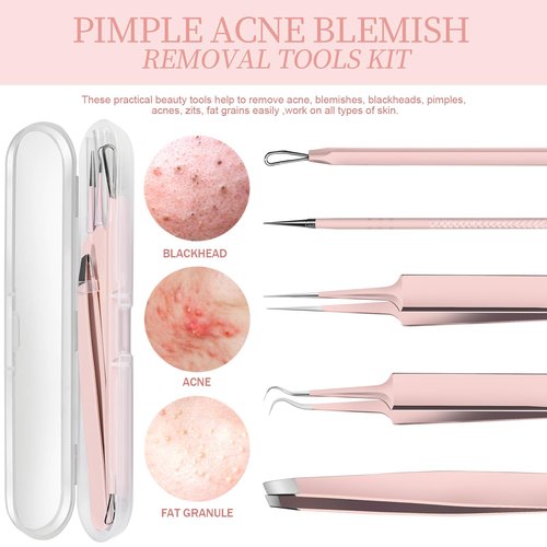 Teenitor Blackhead Remover Kit, Pimple Popper Tool Kit, 2 Blackhead Extractor, 1 Ingrown Hair Tweezers, 2 Pimple Extractor Pore Extractor Acne Tools for Face