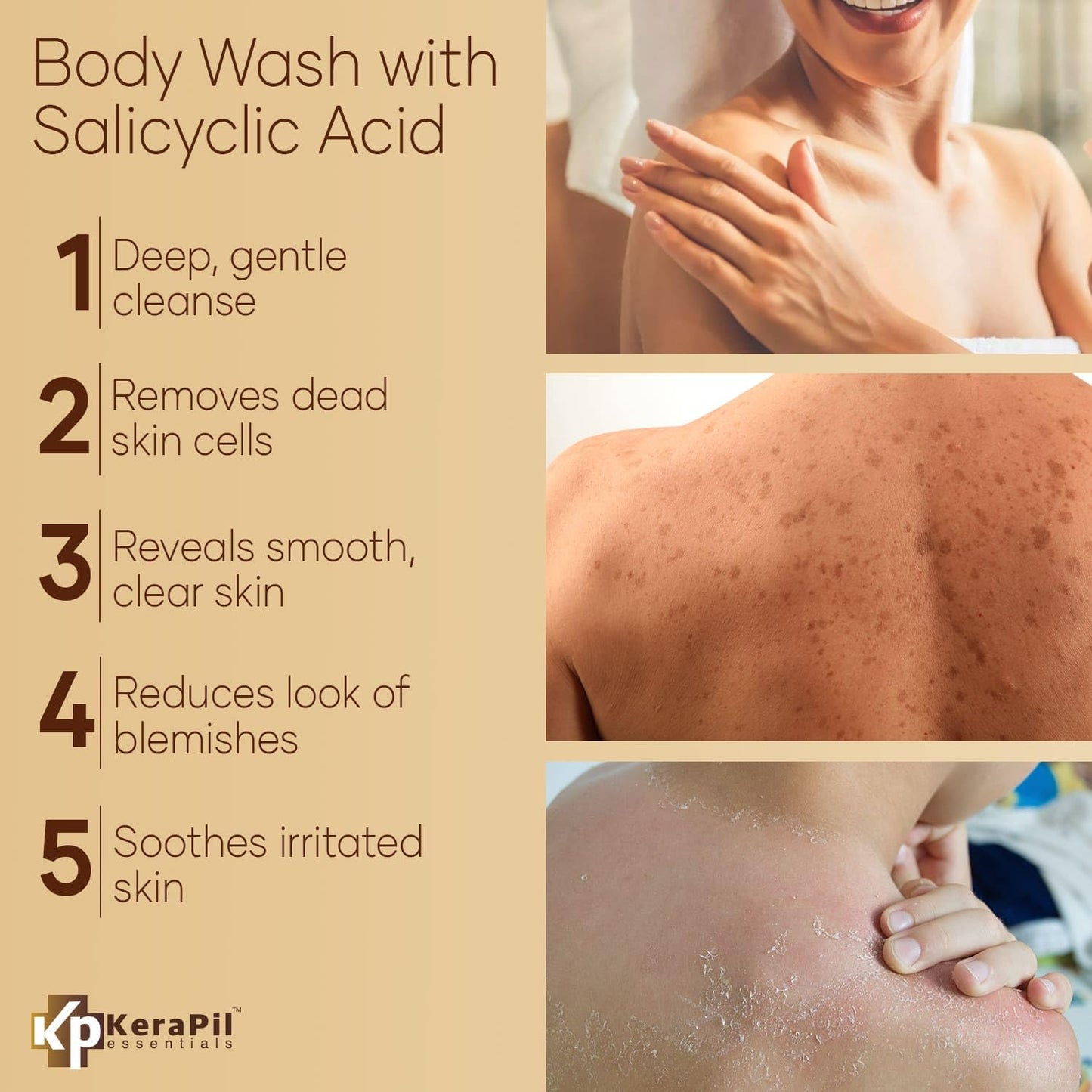 KERAPIL Exfoliating Body Wash, Coconut and Vanilla, 16 fl oz