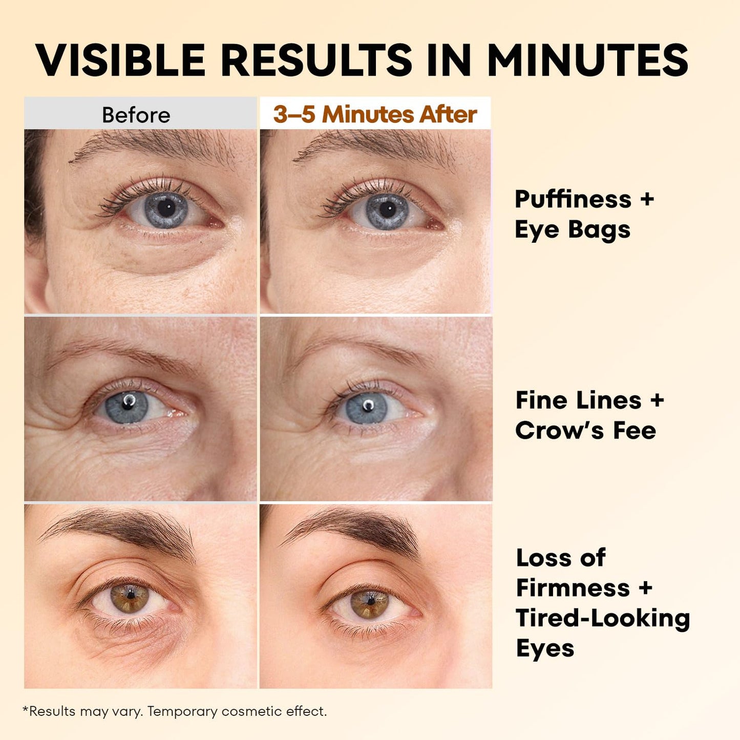 RONKIE Instant Firm Eye Tightener: Upgraded Formula for Women Helps Reduce Eye Bags Puffiness and Wrinkles in 3-5 Minutes When Time Matters 0.67 oz
