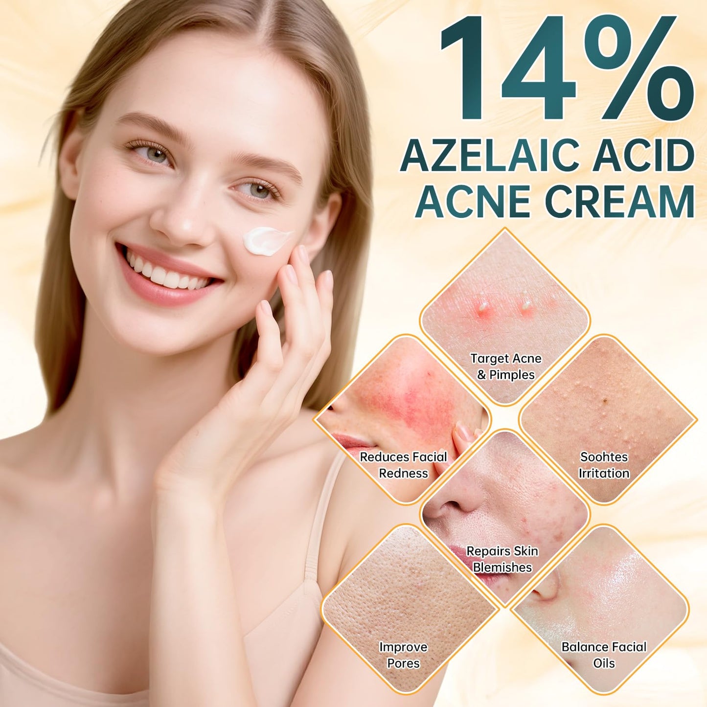 mopayzer Azelaic Acid 14% Face Cream, Premium Acne Treatment with Salicylic Acid & Niacinamide, Calms Facial Redness, Controls Oil & Soothes Skin Irritation, 2 Oz
