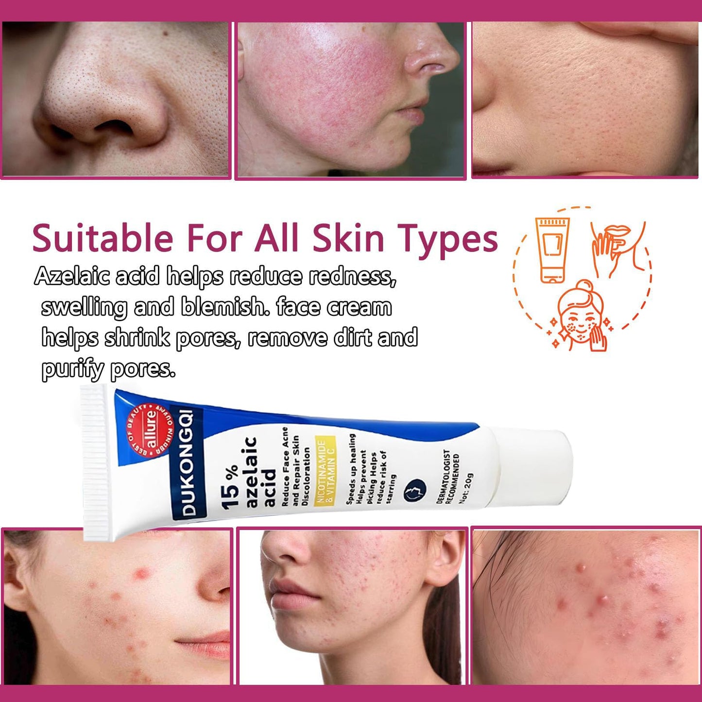 Azelaic Acid for Face Balance Skin Tone & Cleanse Pores, Azelaic Acid Serum Acido Azelaico-Relieve Acne, Blackhead & Redness,Premium Skin Care, 20g (1 PCS)