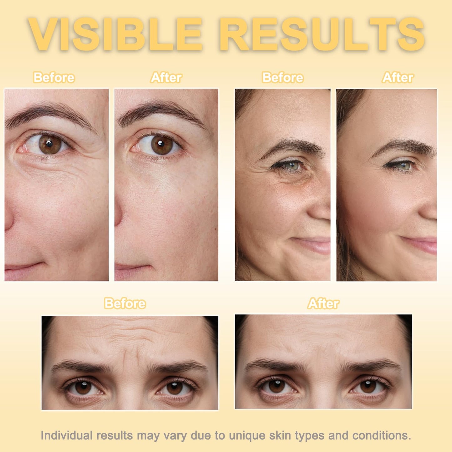 Face Tape for Wrinkles Overnight, Wrinkle Tape for Face, Face Lift Tape 5cm