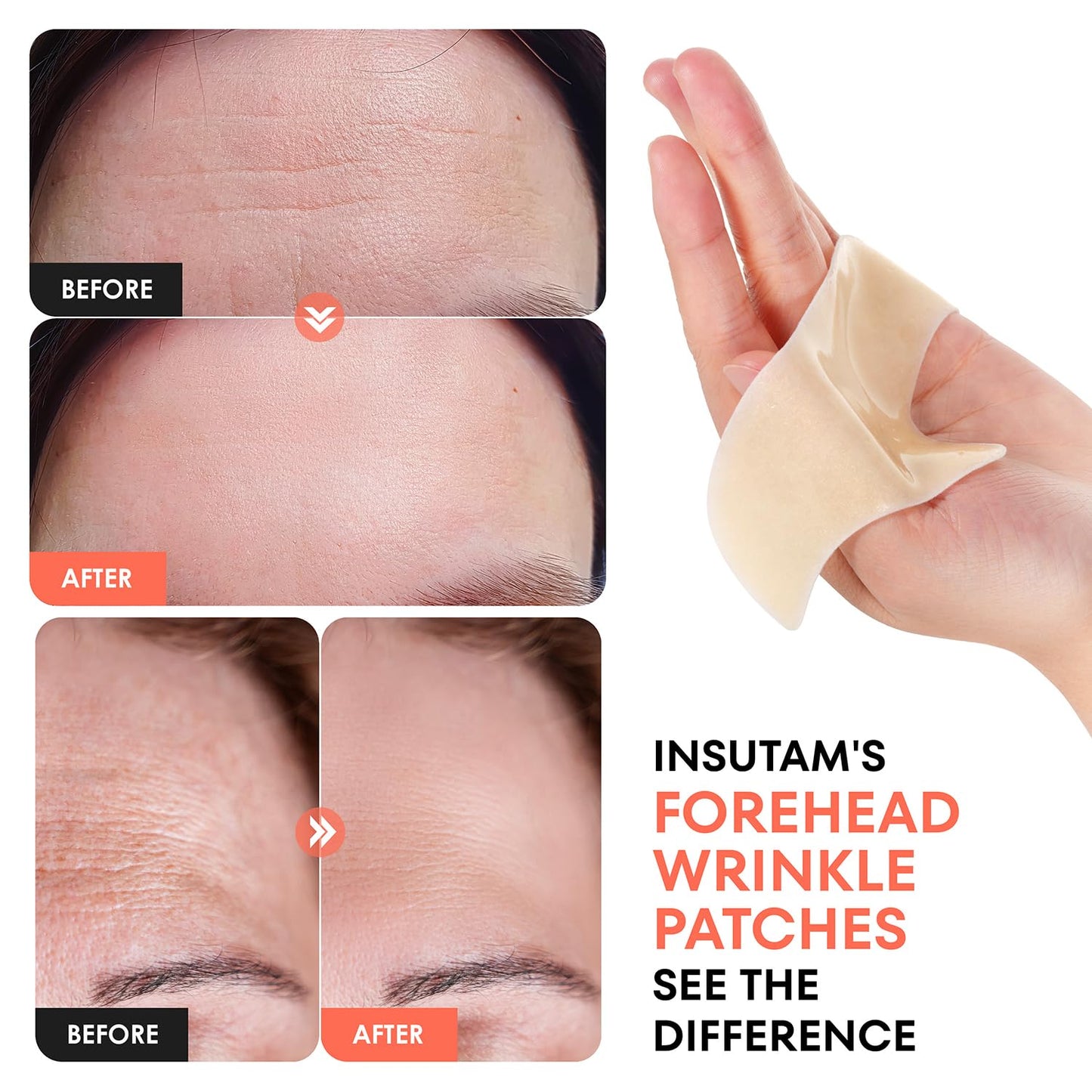 Insutam Forehead Wrinkle Patches for Anti-wrinkles: Overnight Face Wrinkles Patches to Lift Smile Lines for Women (ROSE GOLD)