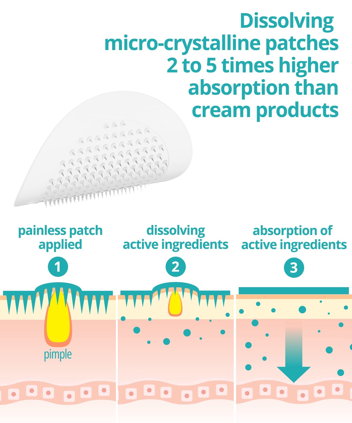 VILVIN Microdart Acne Patch for Deep Blemish - 9 Patches - Dark spot remover for face - Fast Acting Microdart Pimple Patches for face - Hyaluronic Acid, Tea Tree