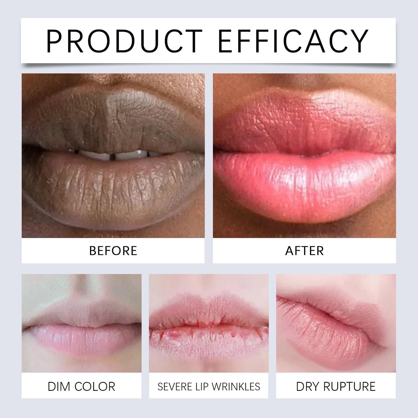 Lip Lightening Balm with SPF - Lip Lightening for Dark Lips, Black Lips Corrector Cream, SPF Lips Sunscreen/Balm/Moisturizer forLips Protection, Softening, Hydration, Repairing (2PCS)