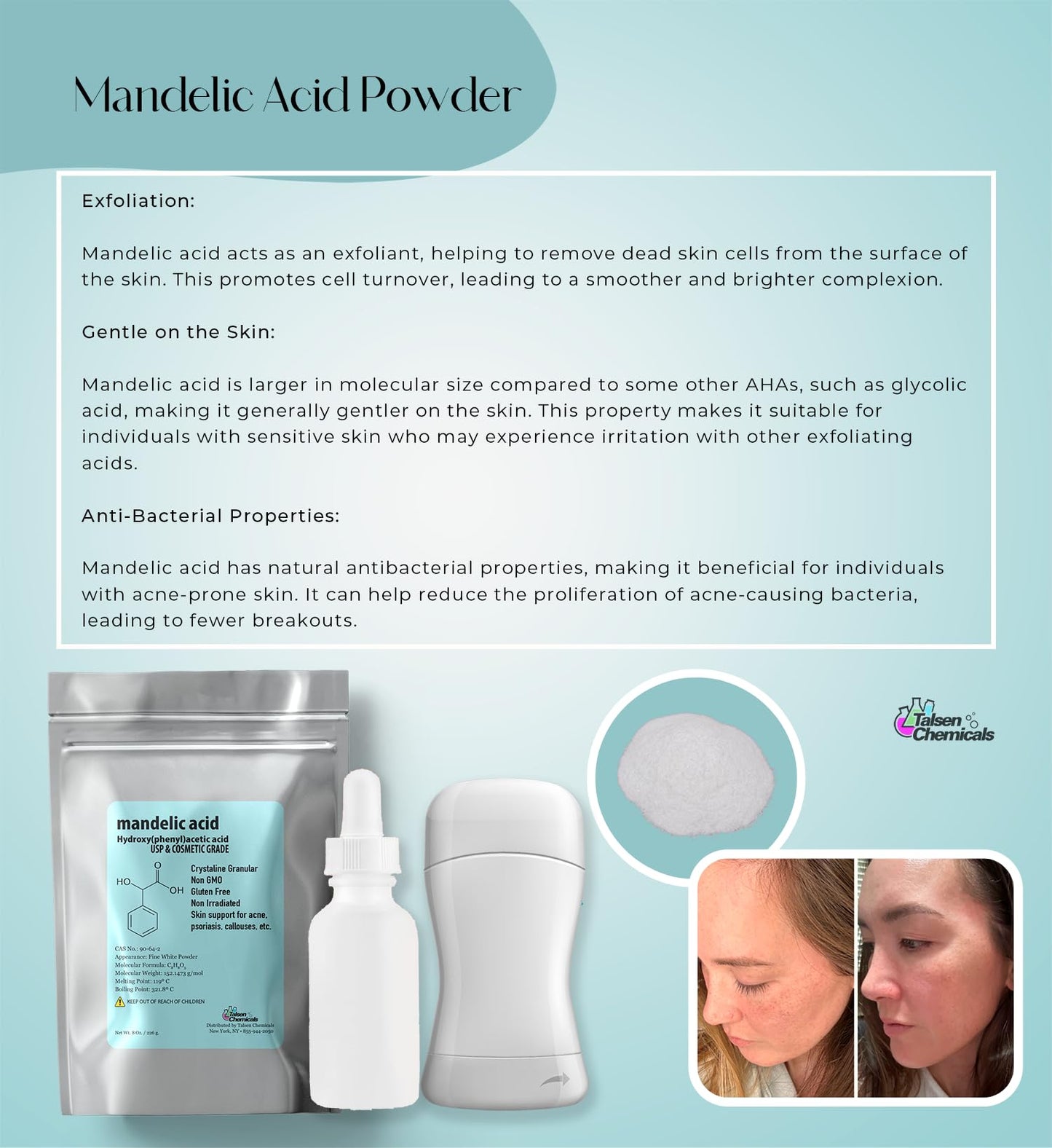 Talsen Chemicals Mandelic Acid Powder 99.9% Purity, DIY Cosmetic Grade For Mandelic Acid Serum, Peel/Mask or add to Cream, Moisturizer (8 Ounce / 226 Gram)