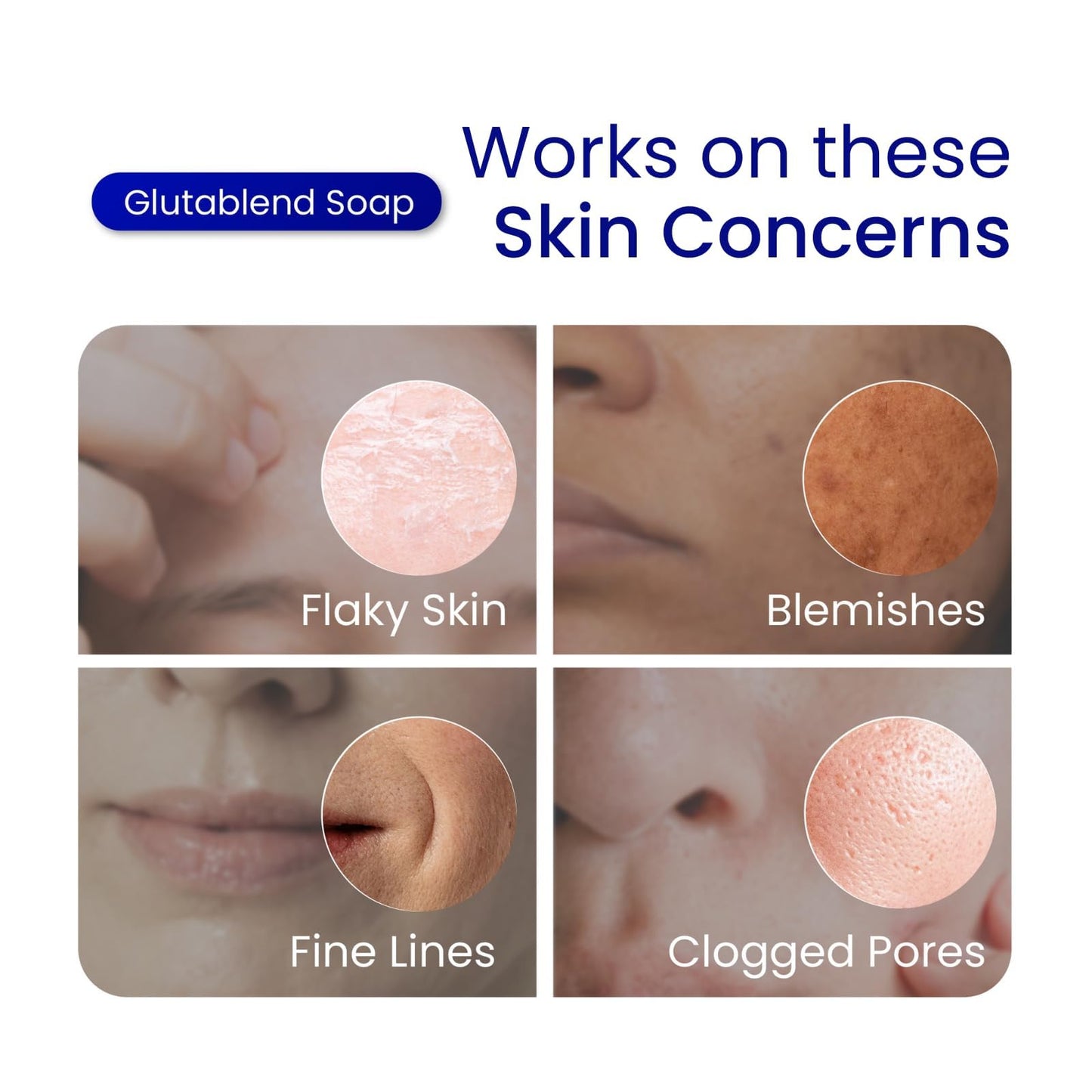 Relumins Premium 3-in-1 Glutablend Exfoliating Peeling Soap Bar, Skin Whitening Dark Spot Corrector, Anti-Aging Beauty Soap with Rosehips – Gentle Face & Body Cleanser 120g