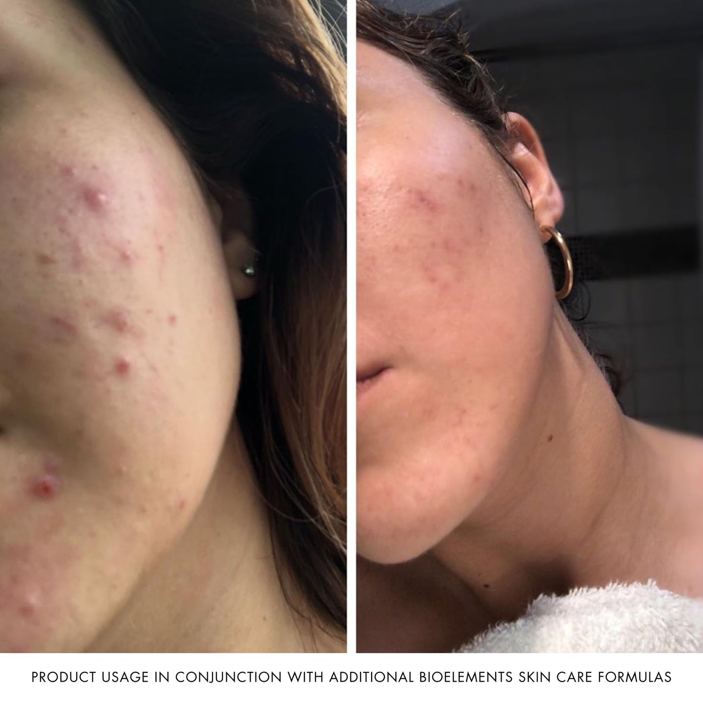 Bioelements Skin Editor - 1.7 fl oz - Leave-On AHA Chemical Face Peel Cream for All Skin Types - With 3% Glycolic Acid & 7% Lactic Acid - Vegan, Gluten Free - Never Tested on Animals