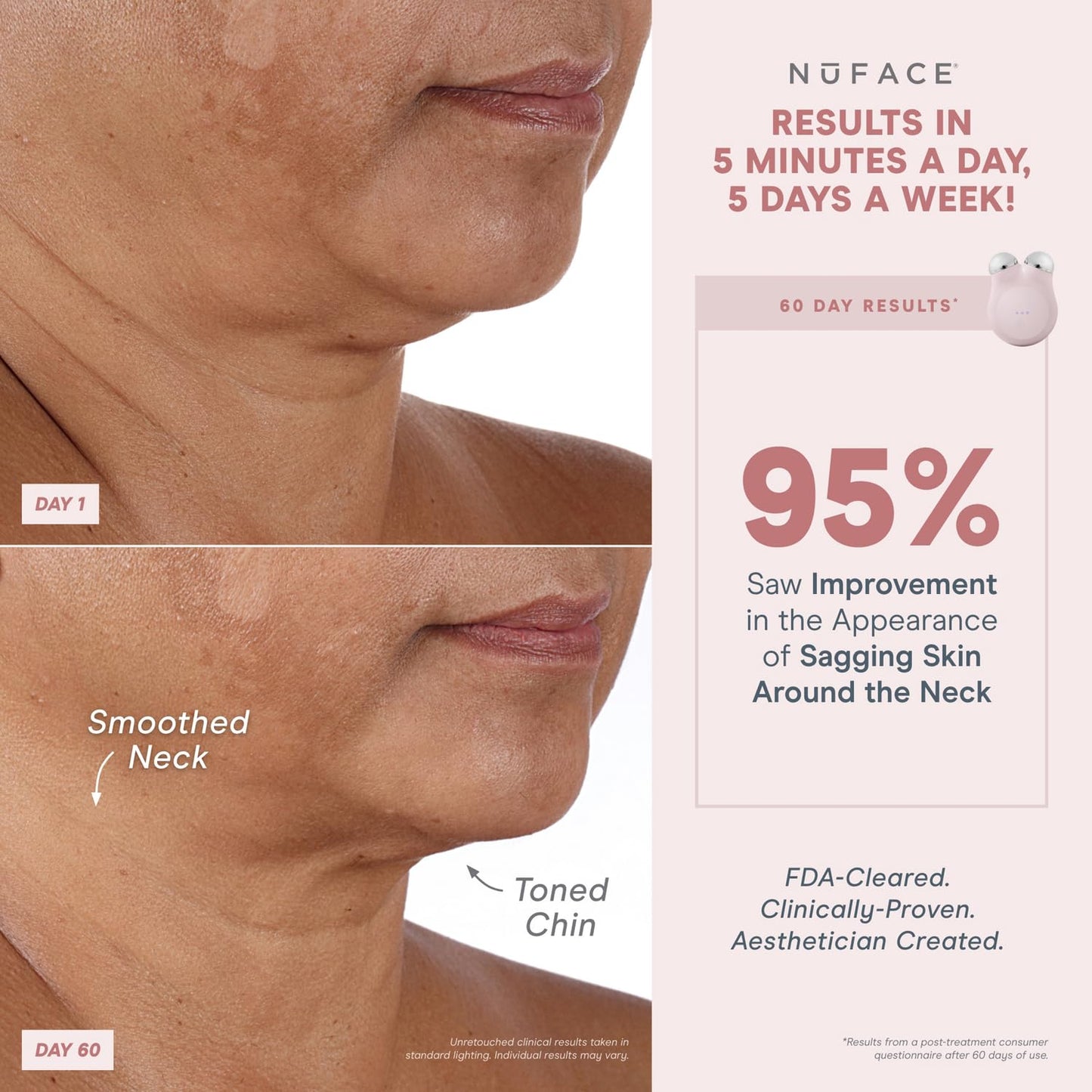 NuFACE MINI+ Microcurrent Facial Device Kit - FDA Cleared Face Sculpting Device to Contour, Lift & Tone + Microcurrent Gel Activator - NuBLUE