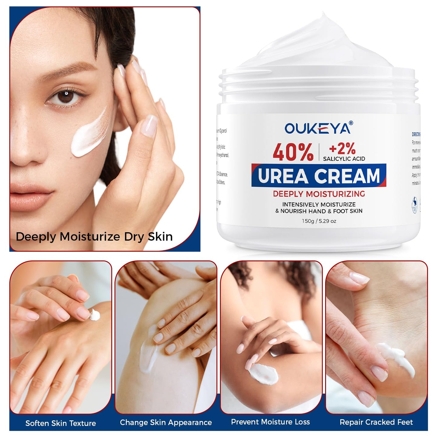 OUKEYA NEW FORMULA Urea Cream 40% Plus 2% Salicylic Acid for Feet Maximum Strength, Dry Cracked Hand Heel Moisturizing Repair Lotion for Knees, Elbows, Removes Corns, Dead Skin Cream, 5.29 oz