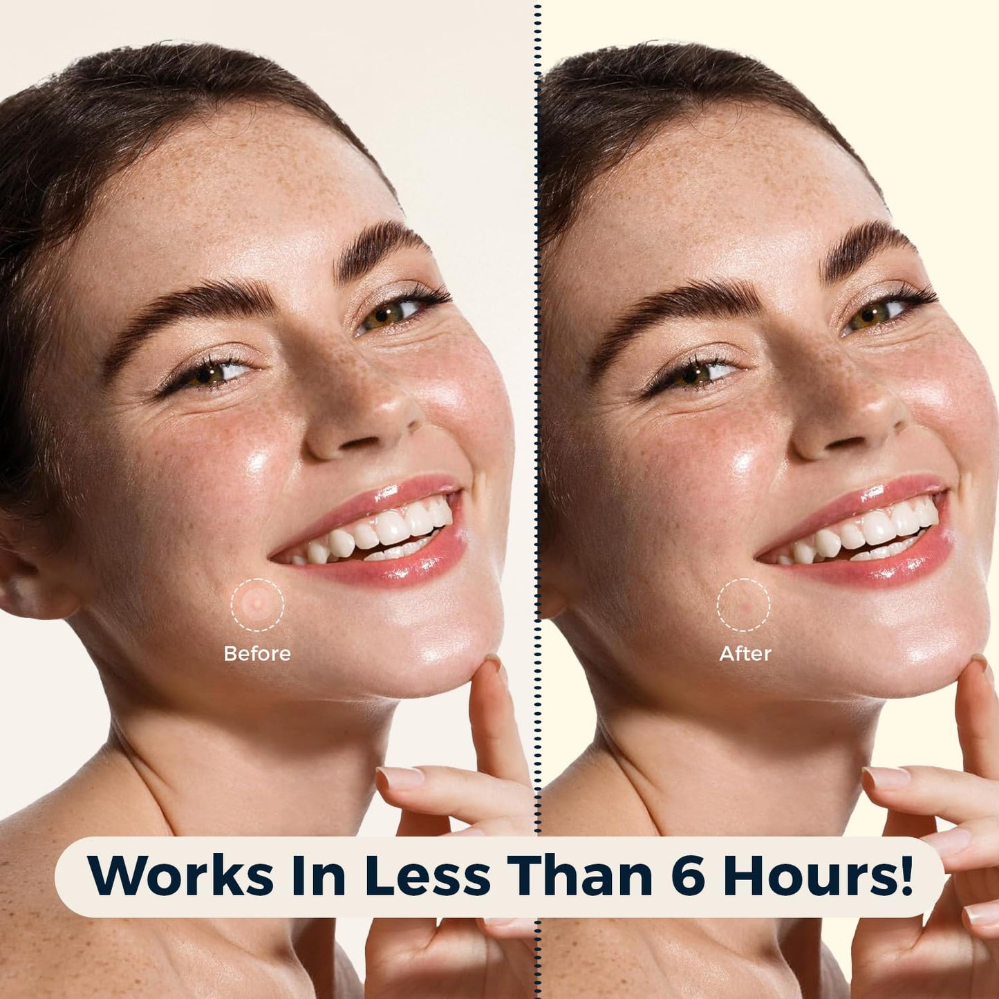 Havenique Pimple Patches for a Face Pack of 324, Acne Patches Hydrocolloid Patches for Covering Zits and Blemishes for Skin Care Spot Day and Night with Salicylic Acid, Tea Tree Oil 9 Star Patches