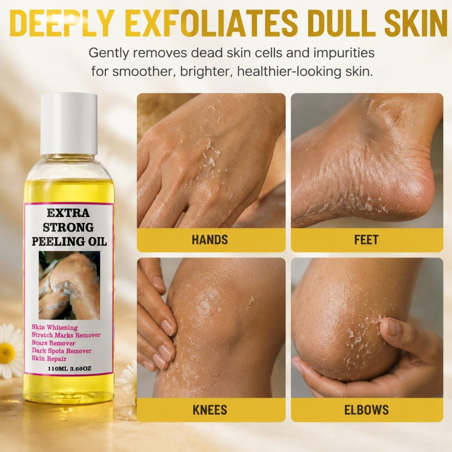Yellow Peeling Oil for Dark Skin, Extra Strong Peeling Oil, Natural Formula Exfoliating Peels Solution for Face, Body, Hands and Foot Dead Skin Remover (220ML/7.76 OZ)