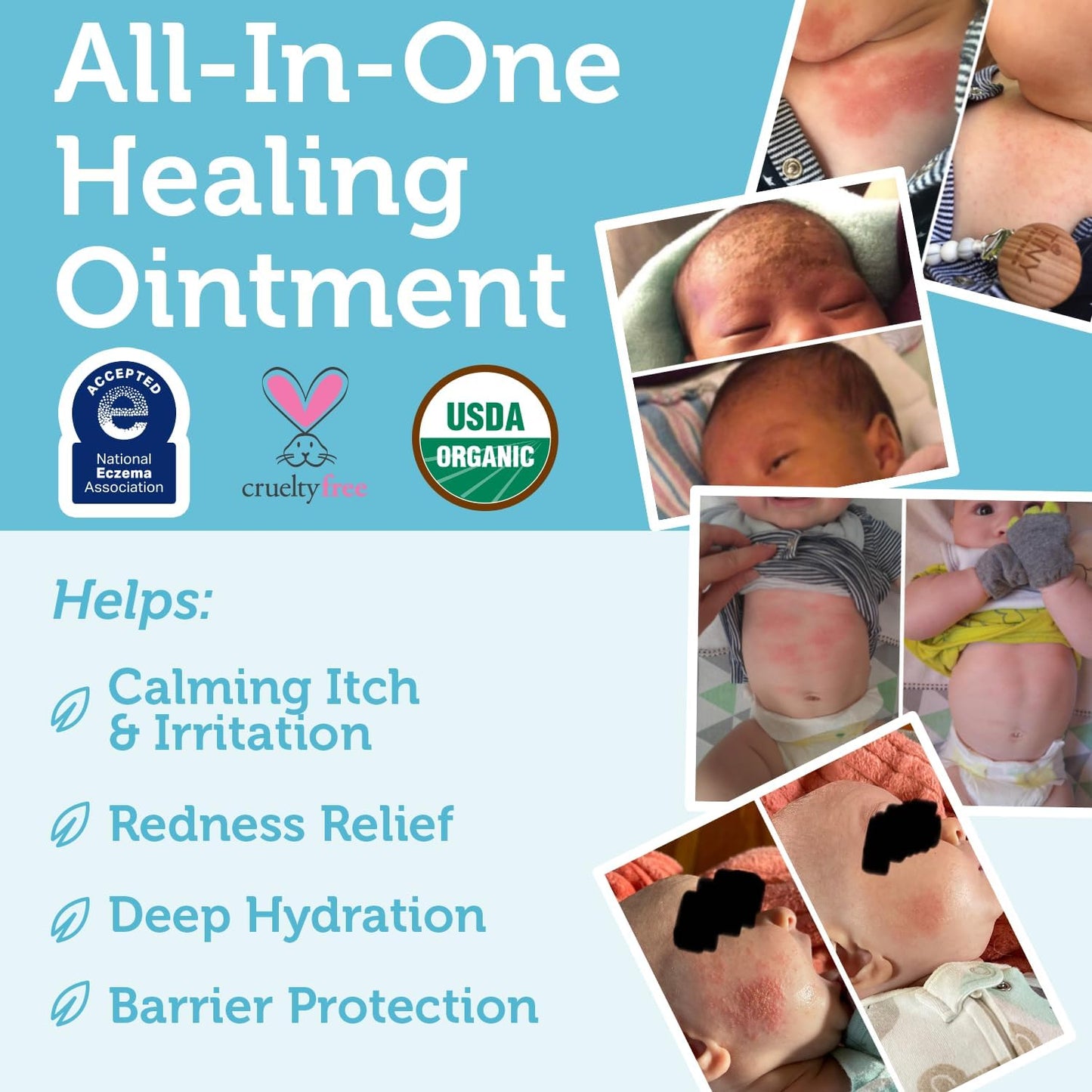 Era Organics Healing Ointment for Babies - USDA Certified Organic Natural Moisturizer Gentle on Sensitive Skin Prone To Baby Eczema, Cradle Cap (Infant Seborrheic Dermatitis), Rashes, Hives 4oz