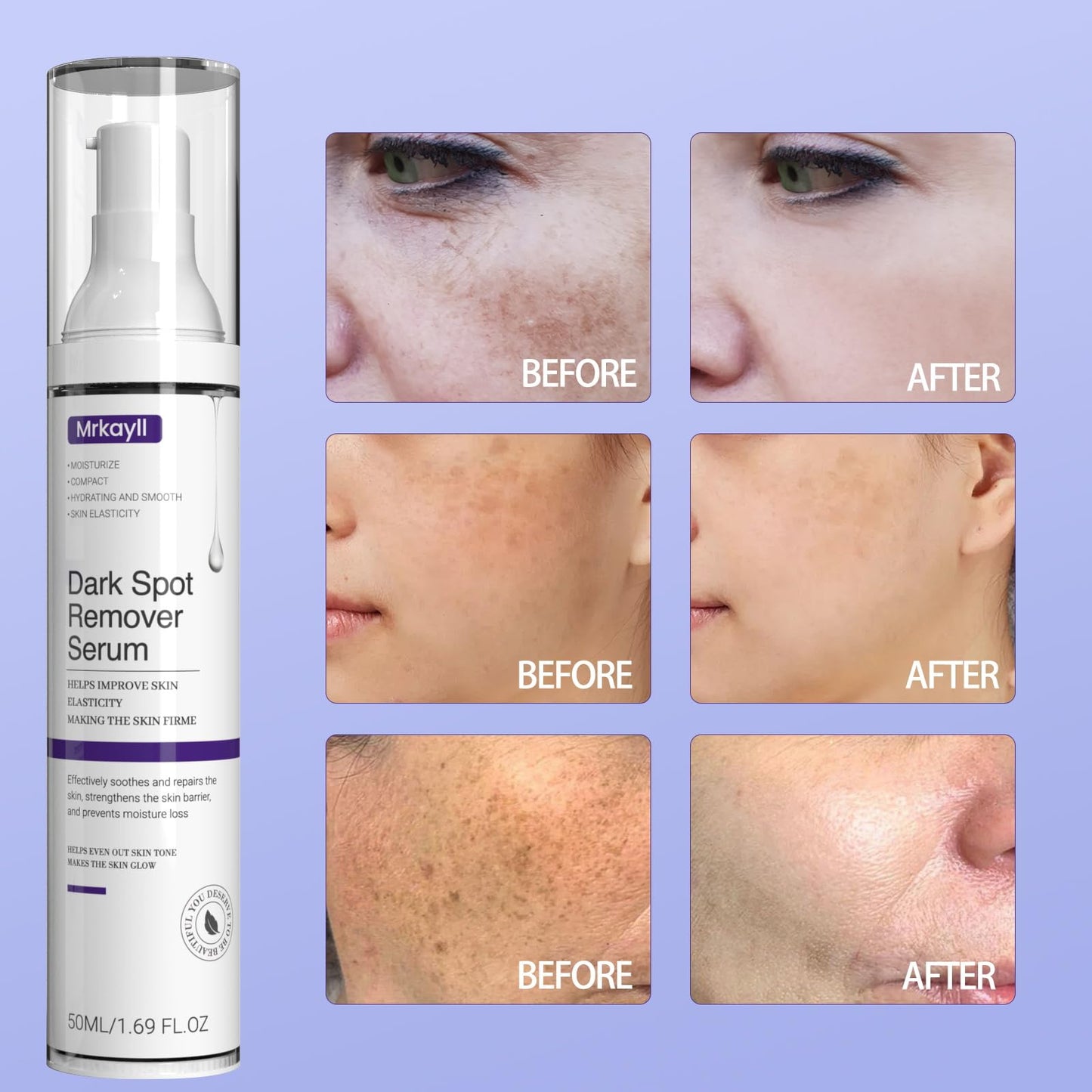 Dark Spot Remover for Face and Body – Niacinamide Correcting Serum for Melasma, Sun Spots, Acne Marks – Gentle Tone-Correcting for Sensitive Skin & Pregnant Women