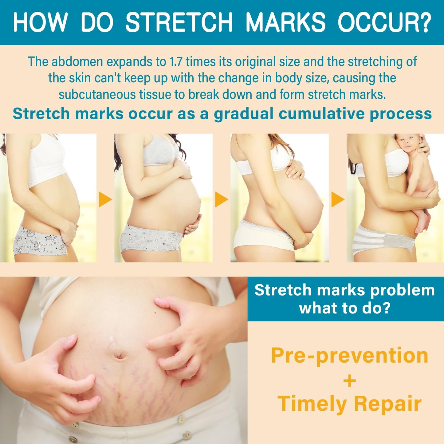 Stretch Mark Cream for Pregnancy & Postpartum,with Argan Oil, Shea Butter & Vitamin E,Stretch Mark Prevention for Belly,Moisturize Skin,Prevent & Fade stretch marks (100ml_1PACK)