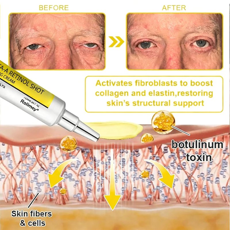 Wrinkle-Lift Tightening Cream - Botoxmix & Vita A Retinol Shot for Youthful Skin | Deep Moisturization (1PC)