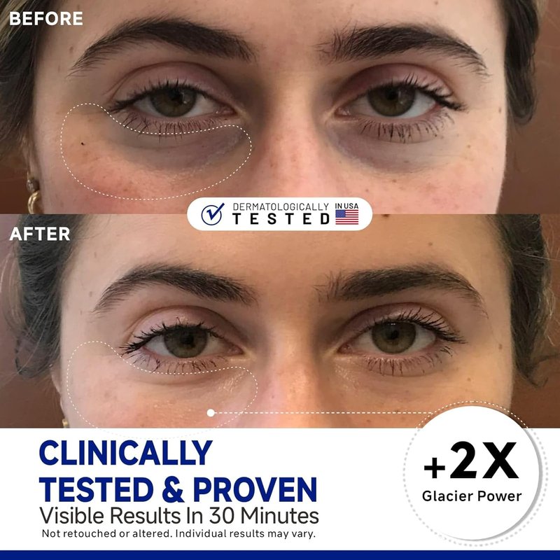 Peptide Cooling Under Eye Patches - Soothing Mask for Dark Circles & Puffiness | 60 Pairs with Glacial Water